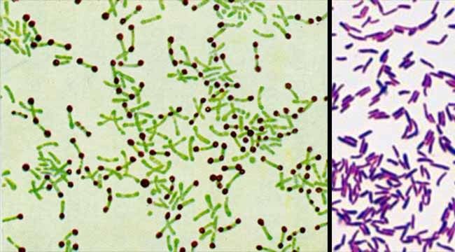 10 Jenis Bakteria Merbahaya Yang Ada Pada Telefon Kita